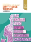 Image for Soft Tissue Tumors