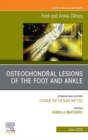 Image for Osteochondral lesions of the foot and ankle