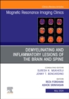 Image for Demyelinating and Inflammatory Lesions of the Brain and Spine, An Issue of Magnetic Resonance Imaging Clinics of North America