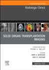 Image for Solid organ transplantation imaging, An Issue of Radiologic Clinics of North America