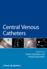 Image for Central venous catheters