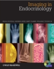 Image for Atlas of endocrine and metabolic disease