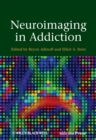 Image for Neuroimaging in addiction