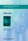 Image for Fibroids