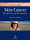 Image for Skin cancer: recognition and management