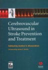 Image for Cerebrovascular Ultrasound in Stroke Prevention and Treatment