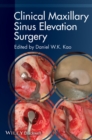 Image for Clinical Maxillary Sinus Elevation Surgery