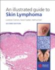 Image for An Illustrated Guide to Skin Lymphoma 2e