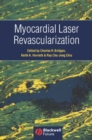 Image for Myocardial laser revascularization