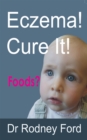 Image for Eczema! Cure It!