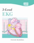 Image for 3-Lead EKG: Ventricular Dysrhythmias (CD)