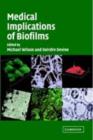 Image for Medical implications of biofilms