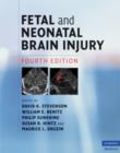 Image for Fetal and neonatal brain injury