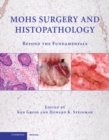 Image for Mohs Surgery and Histopathology: Beyond the Fundamentals