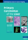 Image for Primary Carcinomas of the Liver