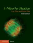 Image for In-vitro fertilization