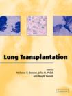Image for Lung Transplantation