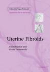 Image for Uterine fibroids  : embolization and other treatments