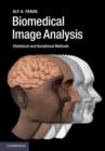 Image for Biomedical image analysis  : statistical and variational methods