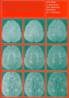 Image for Magnetic Resonance in Multiple Sclerosis