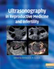 Image for Ultrasonography in reproductive medicine and infertility