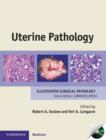 Image for Uterine Pathology