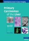 Image for Primary Carcinomas of the Liver