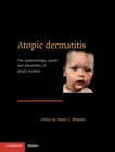 Image for Atopic Dermatitis