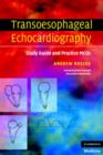 Image for Transoesophageal Echocardiography