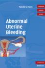 Image for Abnormal uterine bleeding
