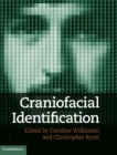 Image for Craniofacial identification