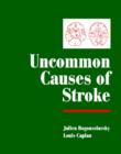 Image for Uncommon Causes of Stroke