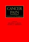 Image for Cancer pain