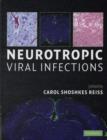 Image for Neurotropic Viral Infections