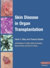 Image for Skin disease in organ transplantation