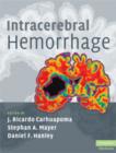 Image for Intracerebral Hemorrhage