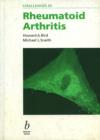 Image for Challenges in Rheumatoid Arthritis