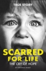 Image for Scarred for Life : The Cry Of Hope