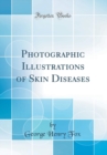 Image for Photographic Illustrations of Skin Diseases (Classic Reprint)