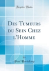 Image for Des Tumeurs du Sein Chez l&#39;Homme (Classic Reprint)
