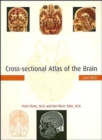 Image for Cross-sectional Atlas of the Brain and DVD