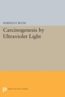 Image for Carcinogenesis by Ultraviolet Light