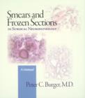 Image for Smears and Frozen Sections in Surgical Neuropathology