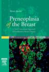 Image for Preneoplasia of the Breast : A New Conceptual Approach to Proliferative Breast Disease