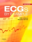 Image for ECGs by Example