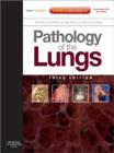 Image for Pathology of the lungs