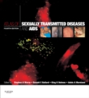 Image for Atlas of sexually transmitted diseases and AIDS.