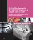 Image for Skeletal anchorage in orthodontic treatment of class II malocclusion: contemporary applications of orthodontic implants, miniscrew implants and miniplates