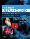 Image for Fetal heart ultrasound: how, why and when : 3 steps and 10 keys points.