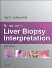 Image for Scheuer&#39;s Liver biopsy interpretation.